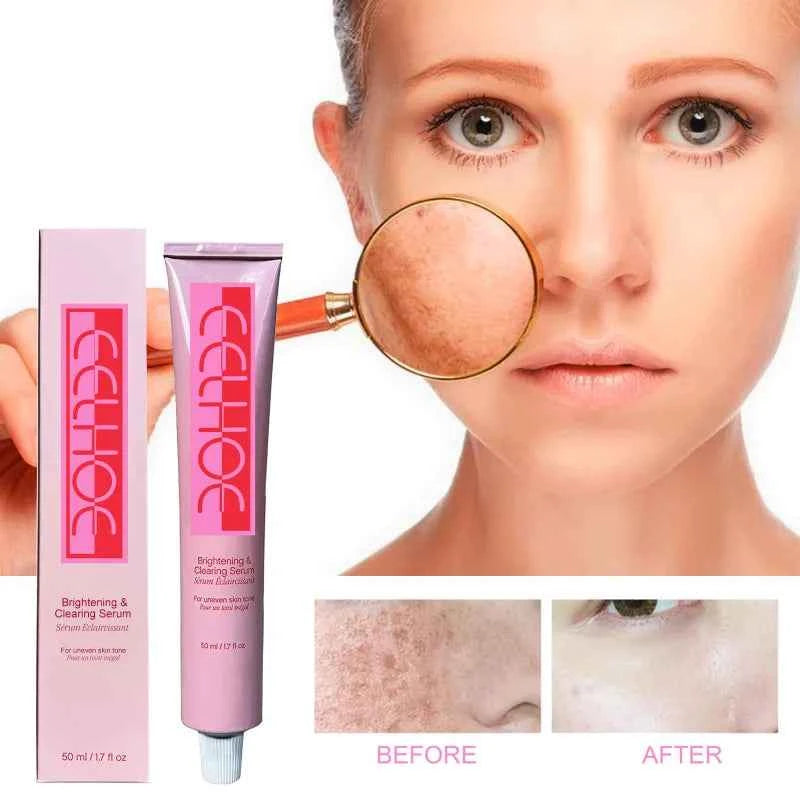 Fade Skin Spots Lotion - Melanin Hydrating Skin Brightening Lotion