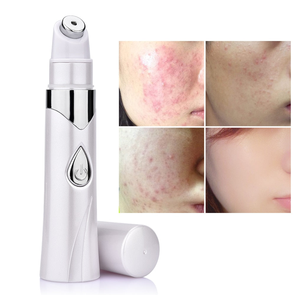 Blue LED light acne treatment