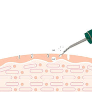 Ultrasonic Cleansing Device for Purifying Facial Cleansing