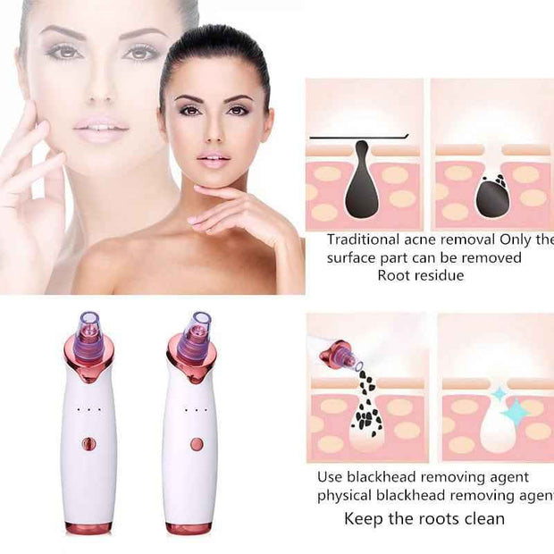 Pore Vacuum Cleaner for Deep Cleansing and Blackhead Removal